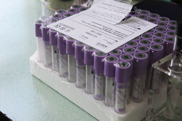 Пандемия коронавируса требует мощного лабораторного обеспечения для проведения тестирования населения.